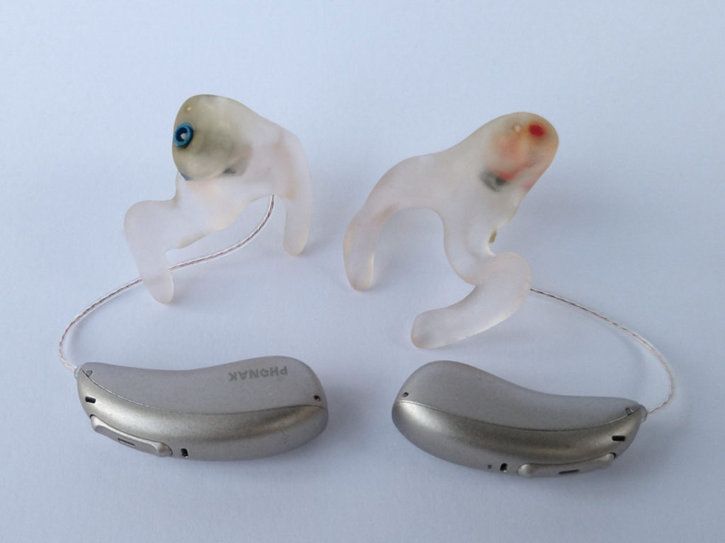2 Hinter-dem-Ohr-Hörgeräte jeweils mit einer Otoplastik.